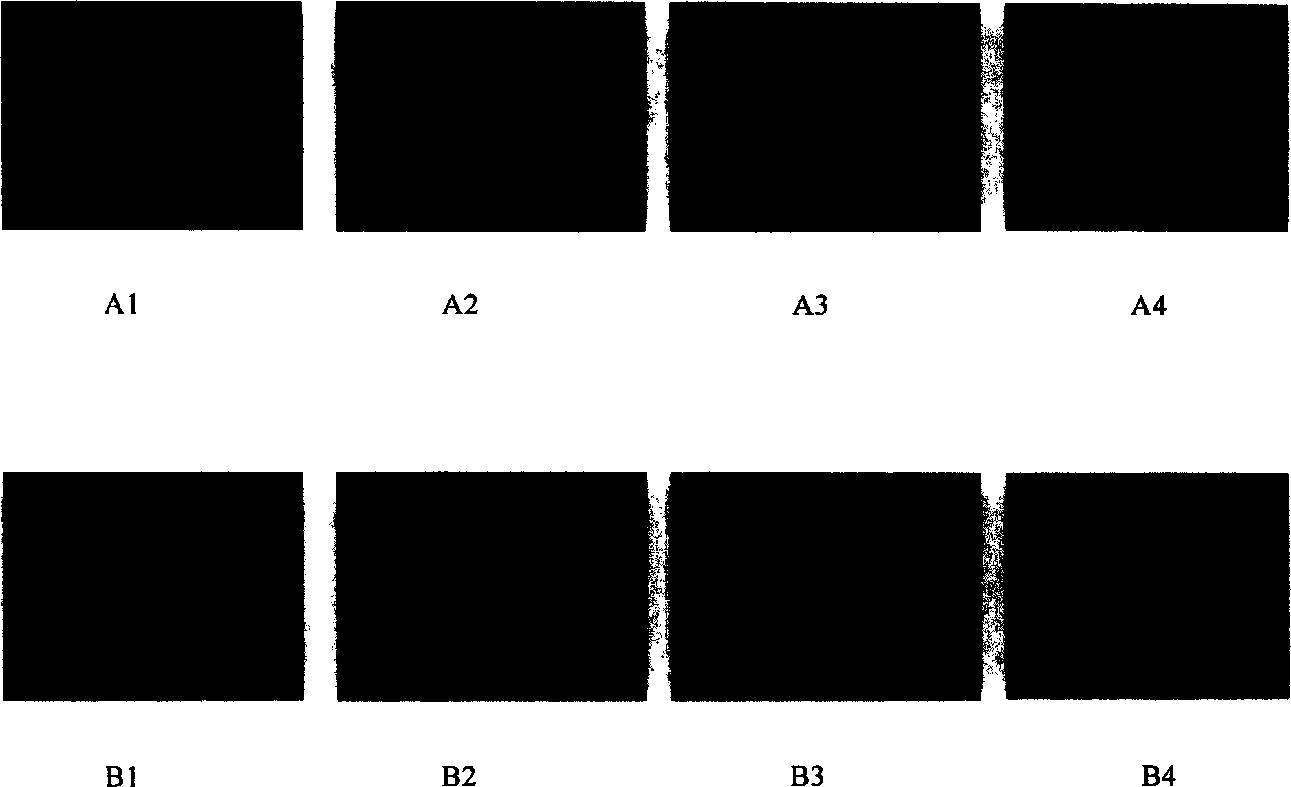 Construction of hepatitis B virus siRNA expression vector and its application in antivirus treatment