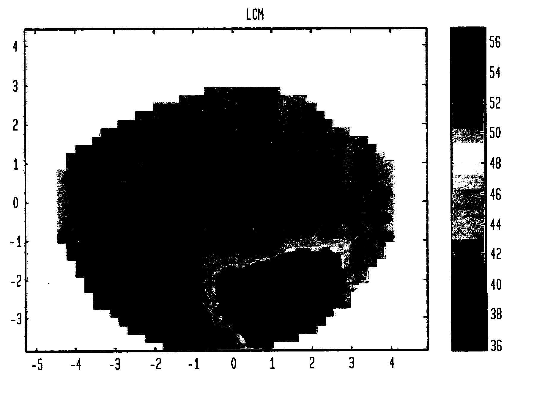 Local average curvature map for corneal topographers