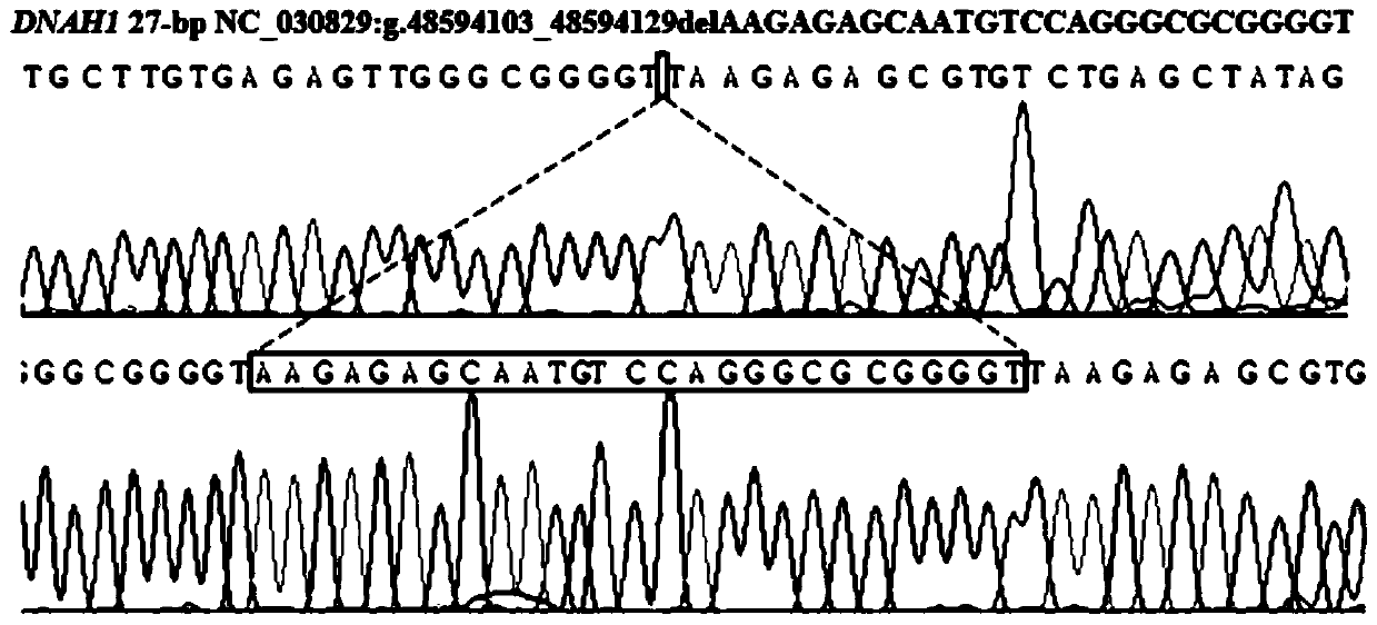 Detection method of insertion/deletion polymorphism of goat DNAH1 gene and application of detection method