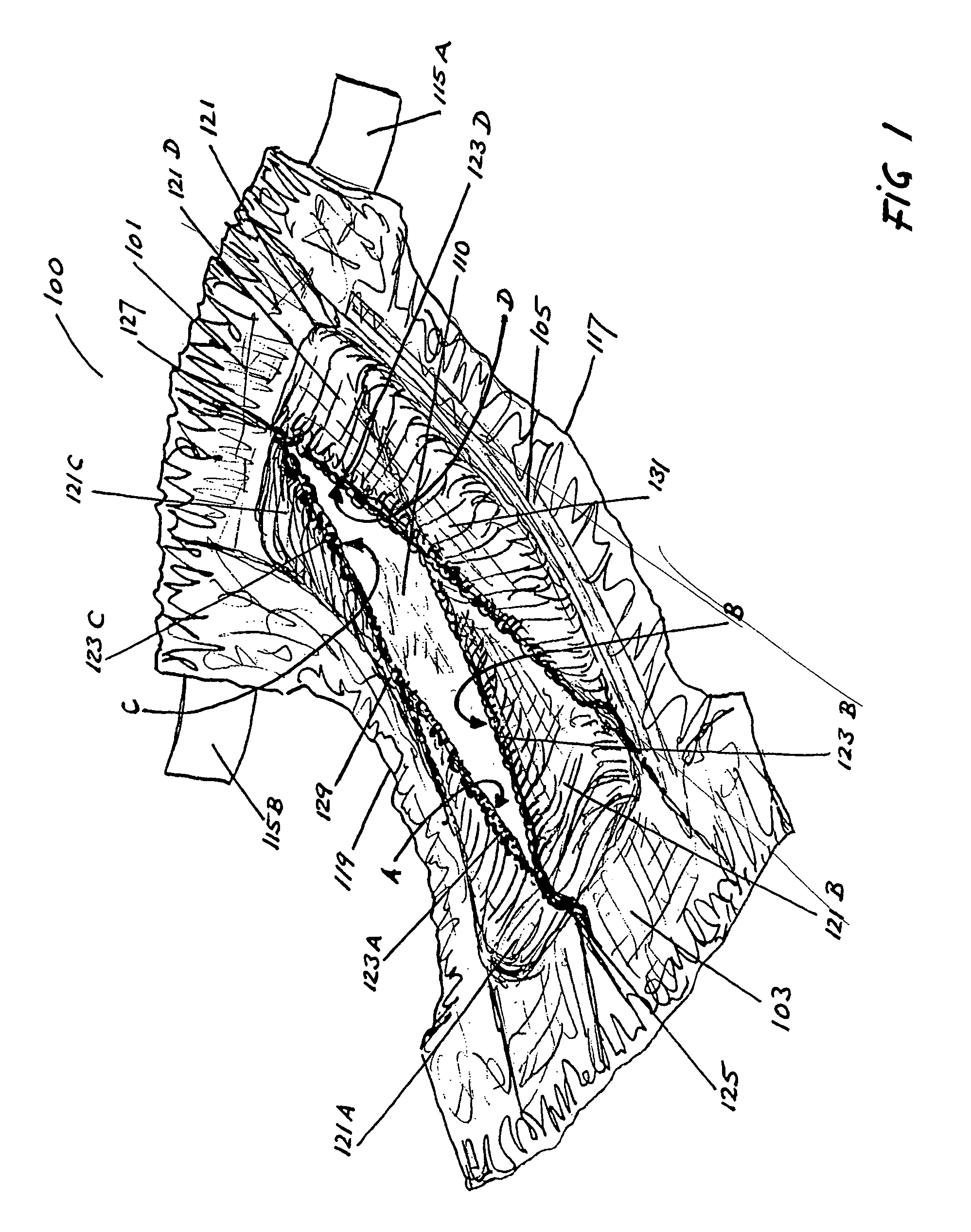 Disposable elastic absorbent article having retaining enclosures