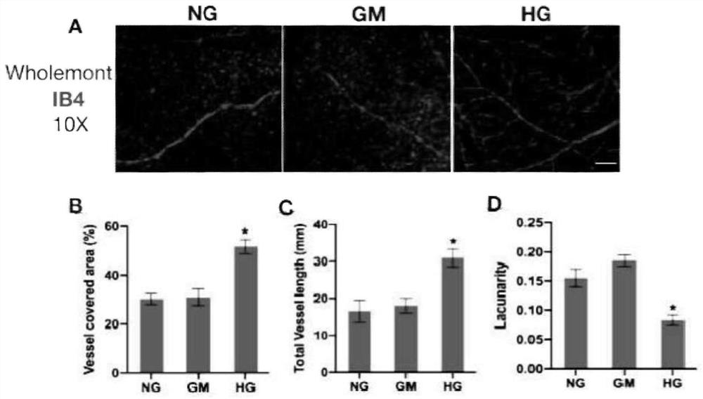 Method for constructing full-retina in-vitro culture model suffering from diabetes retinopathy