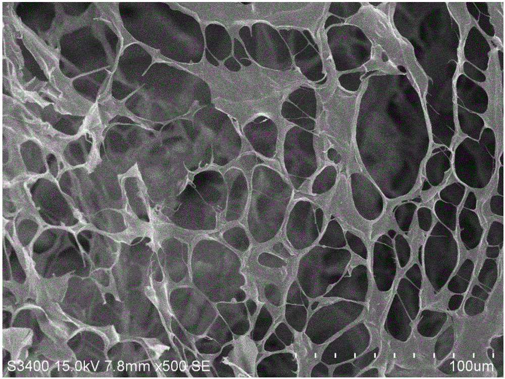 Photosensitive PRP (platelet-rich plasma) gel and preparation method and application thereof