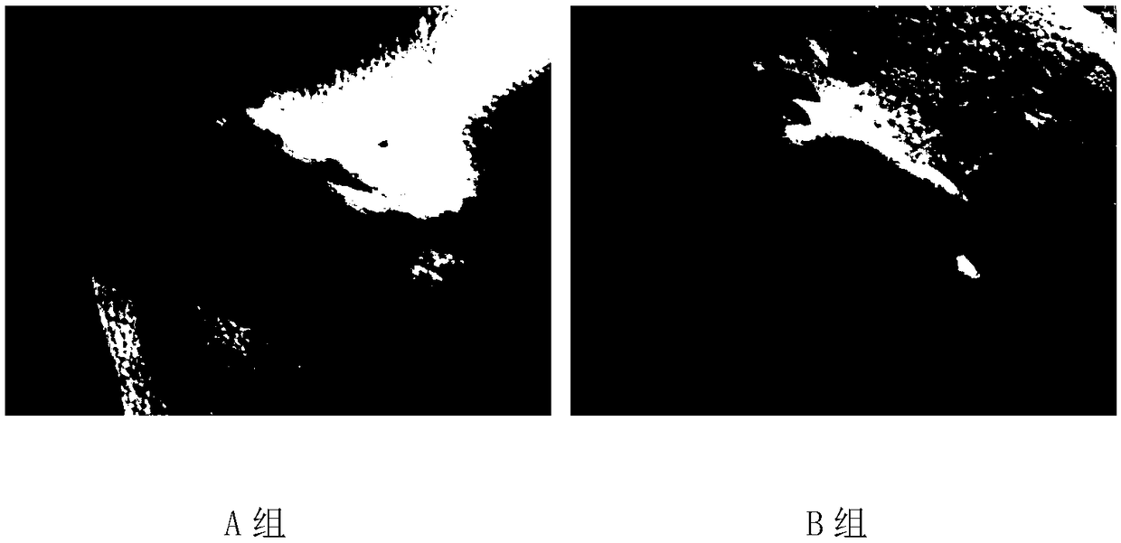 Method of establishing mouse model of functional dyspepsia