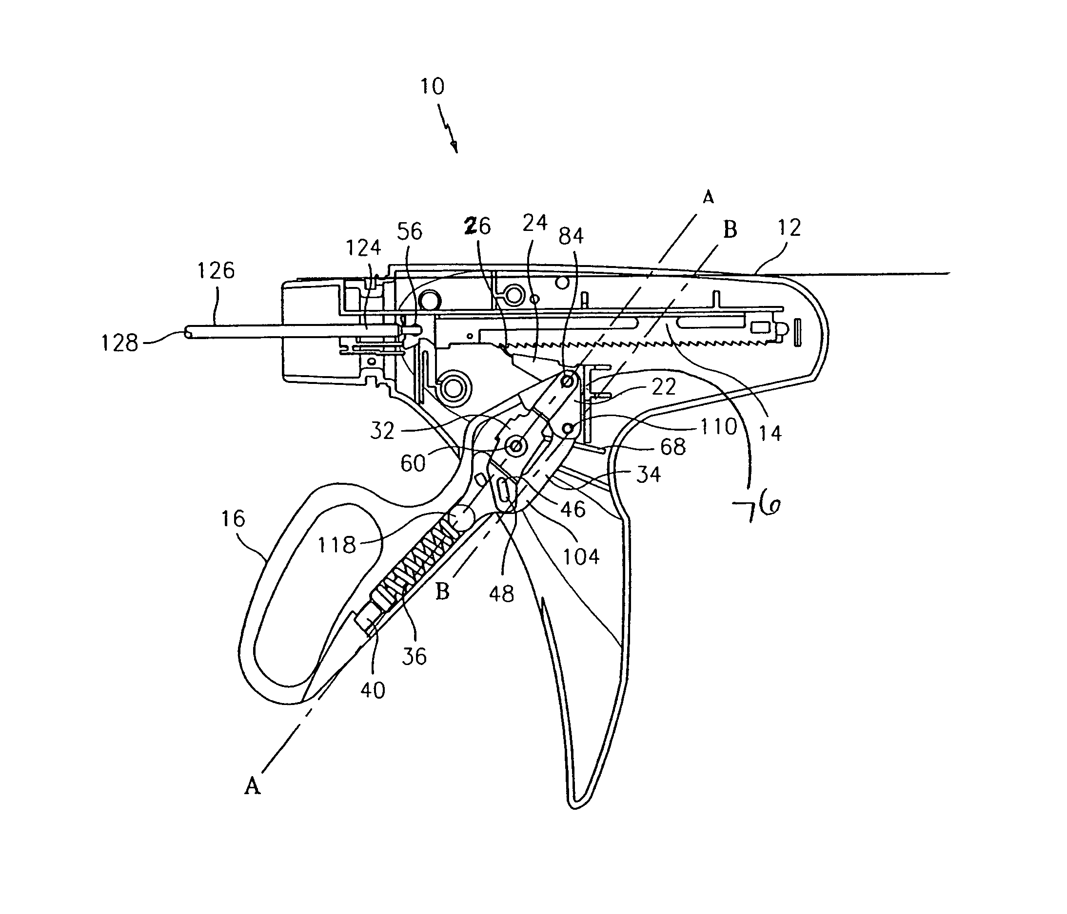 Method and force-limiting handle mechanism for a surgical instrument