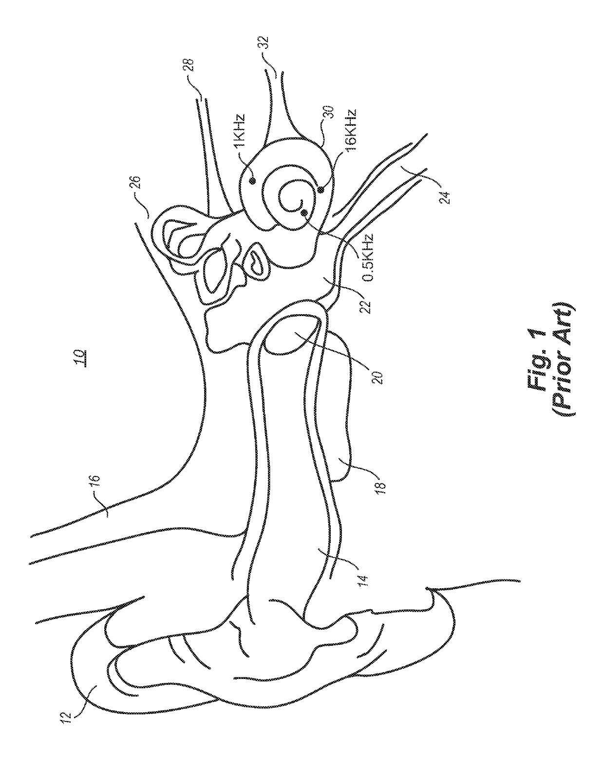 Localized therapeutic hypothermia system, device, and method