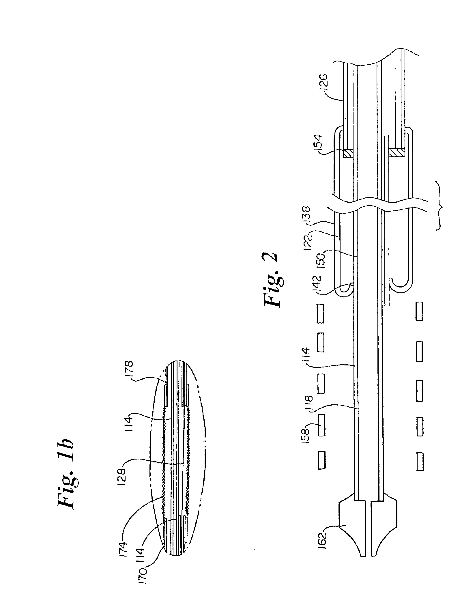 Rolling membrane stent delivery system