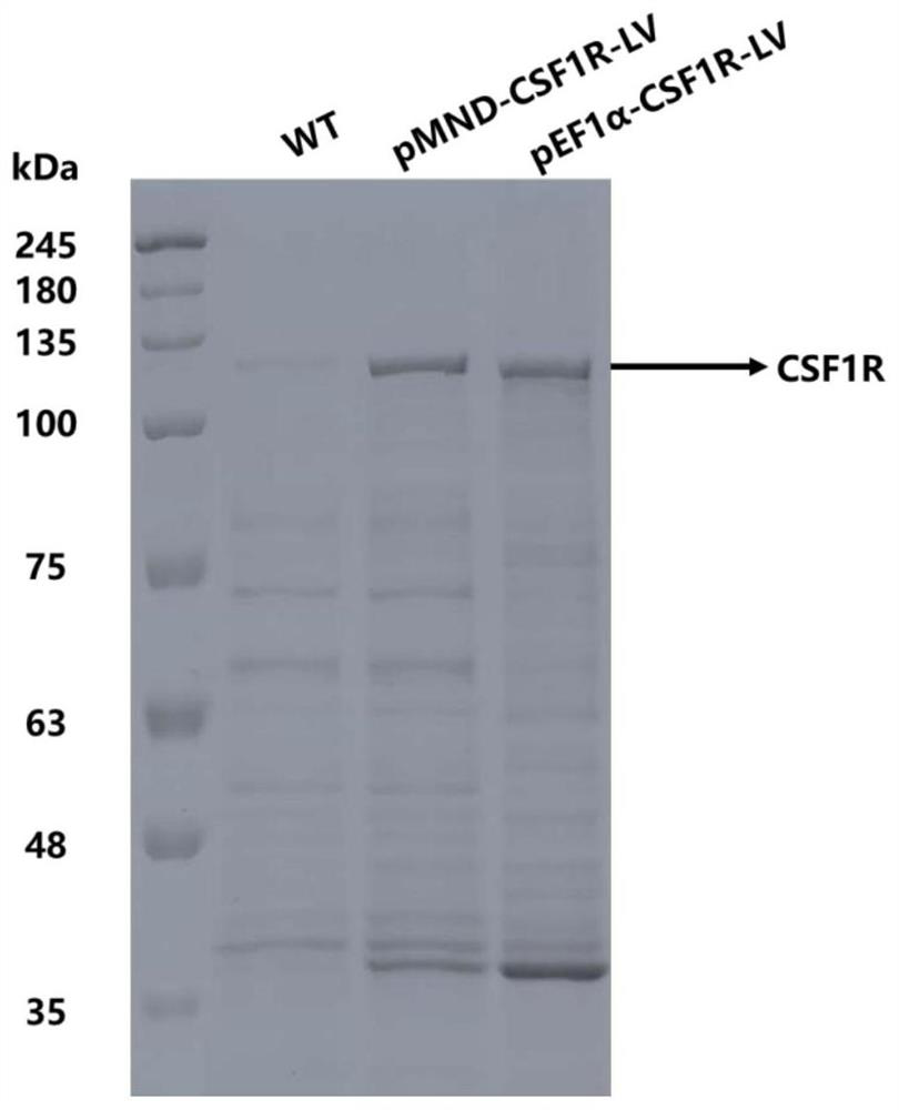 A gene therapy carrier and its use