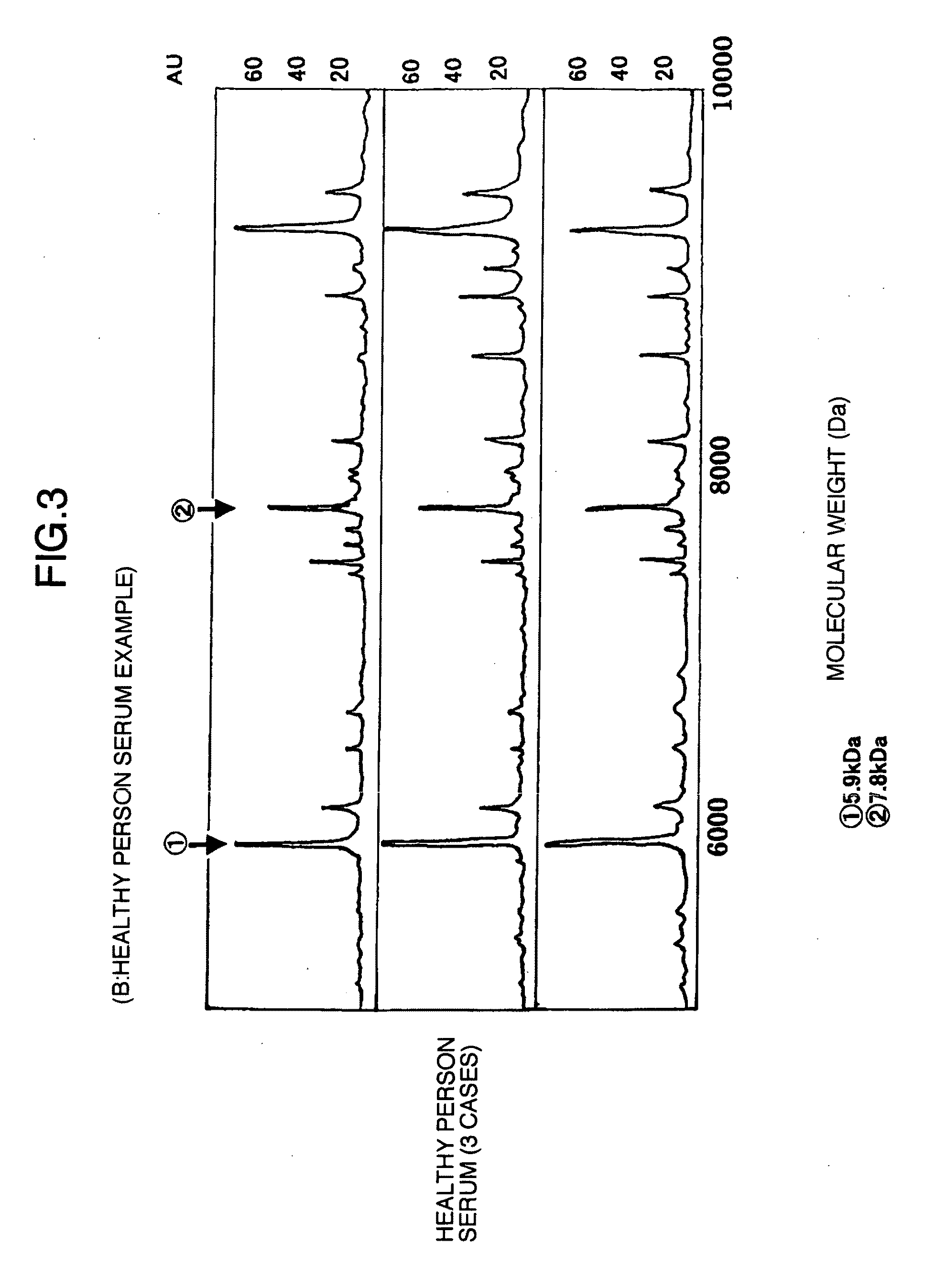 Marker proteins for diagnosing liver disease and method of diagnosing liver disease using the same