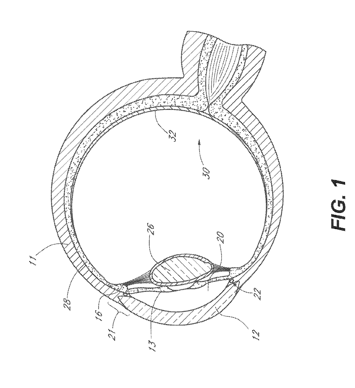 Therapeutic drug compositions and implants for delivery of same