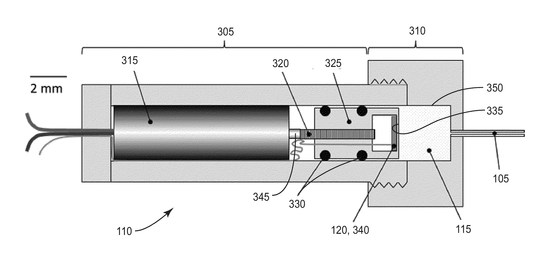 Auto-Regulation System for Intraocular Pressure