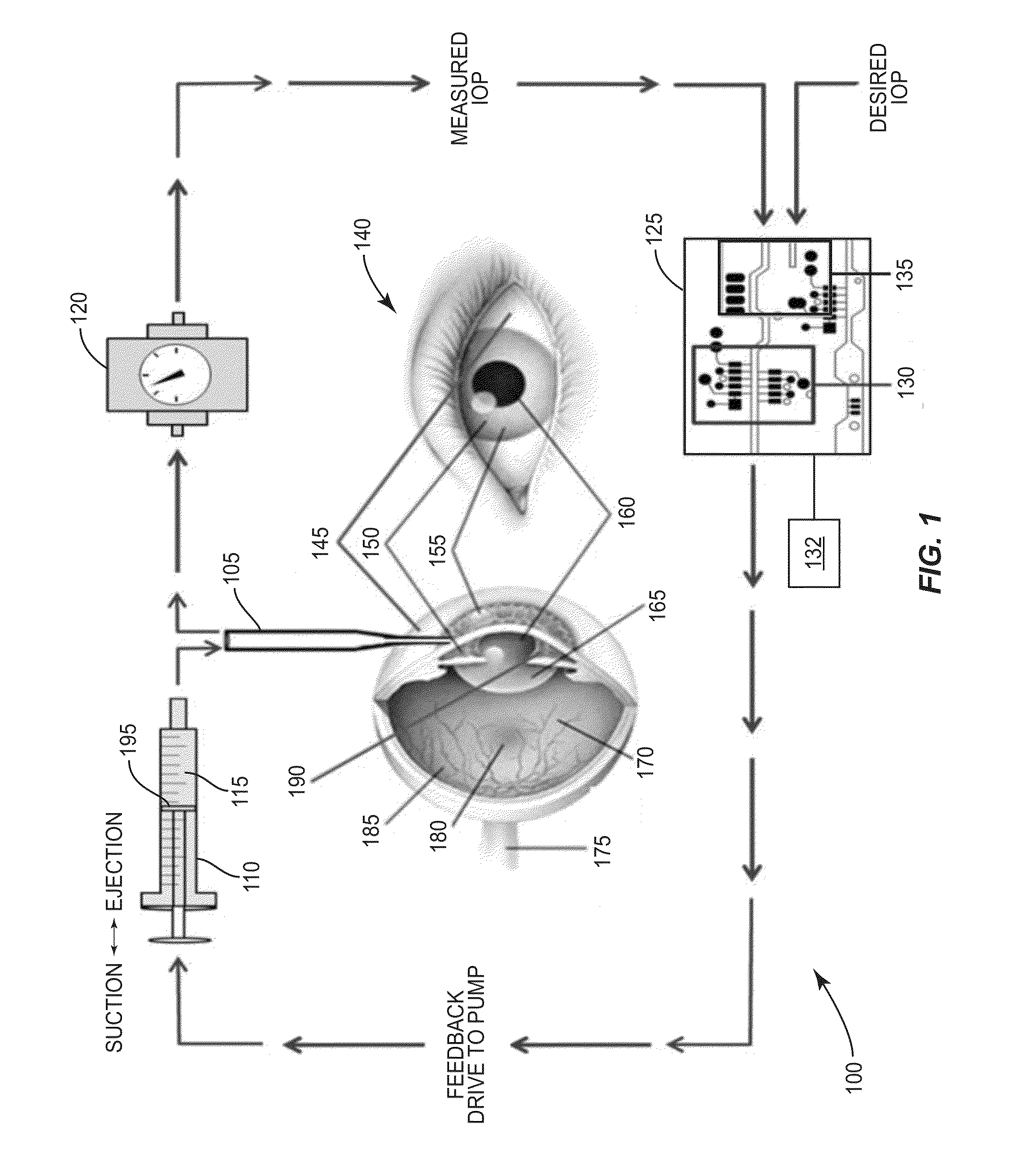 Auto-Regulation System for Intraocular Pressure