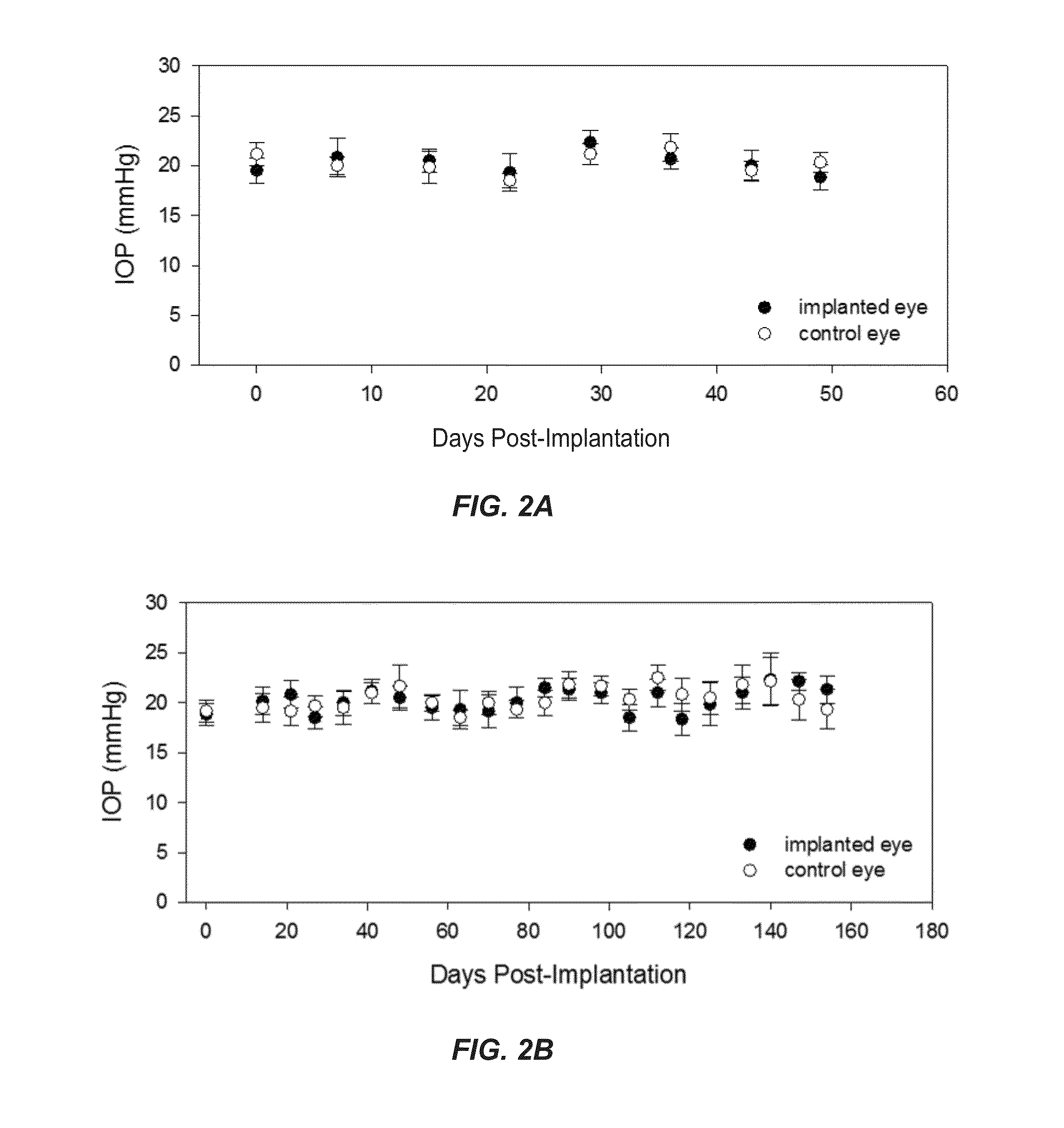 Auto-Regulation System for Intraocular Pressure