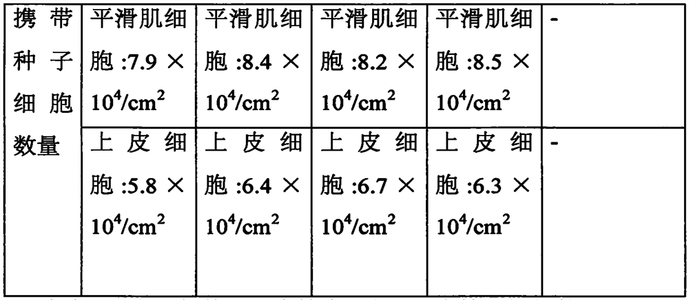 A kind of tissue engineering urethral stent and preparation process thereof