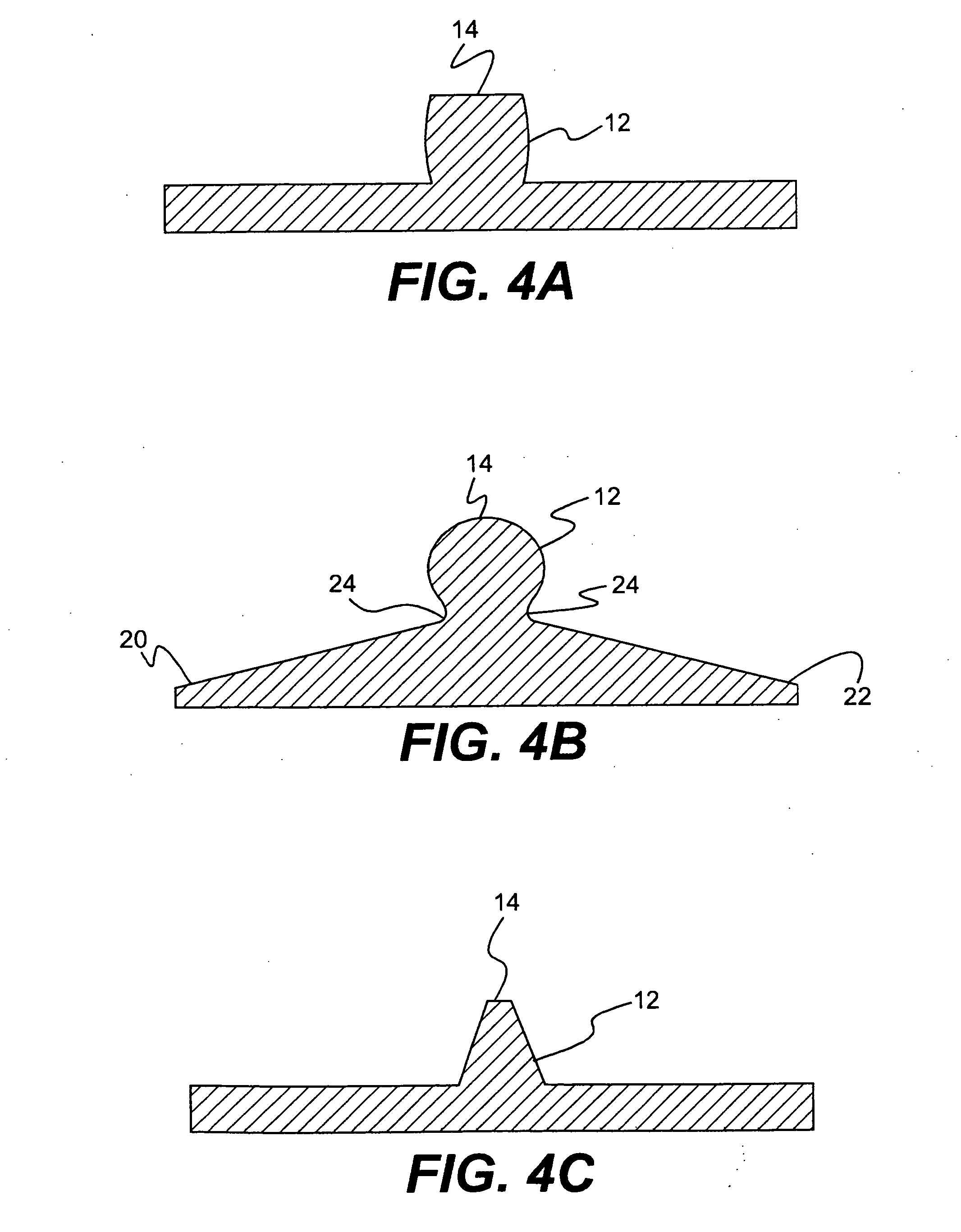 Spinal disc annulus reconstruction method and deformable spinal disc annulus stent