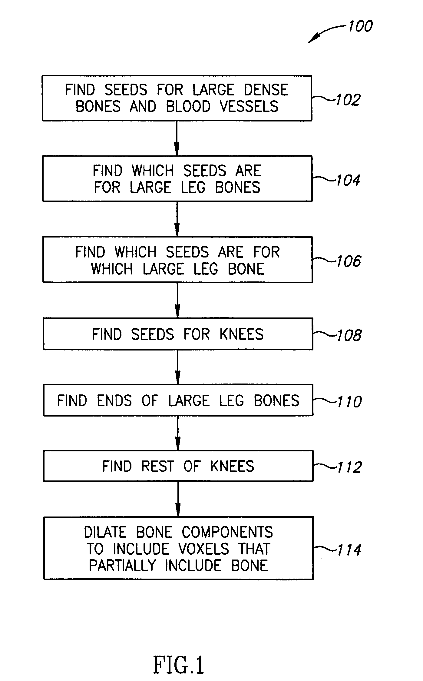 Bone Segmentation