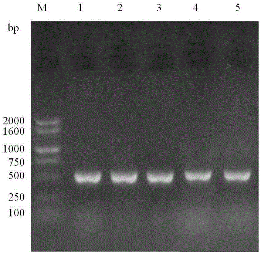 An endophytic fungus with high yield of paclitaxel and method for producing paclitaxel using the strain