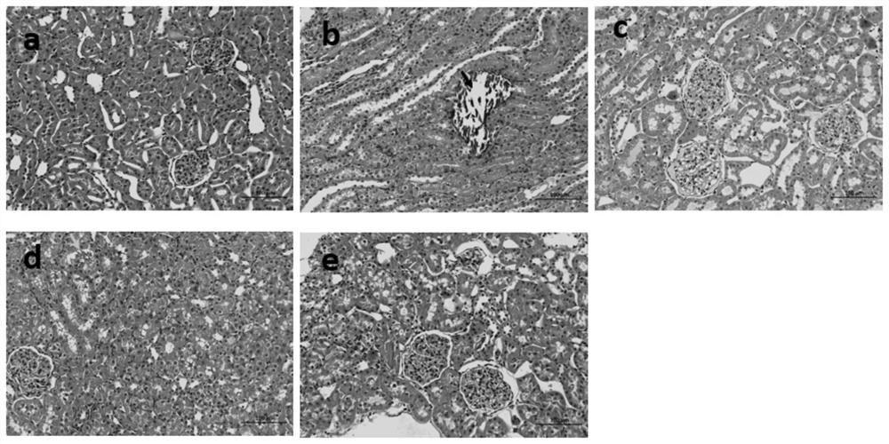 Application, extraction and determination method of raw fructus alpiniae oxyphyllae and salted fructus alpiniae oxyphyllae extract