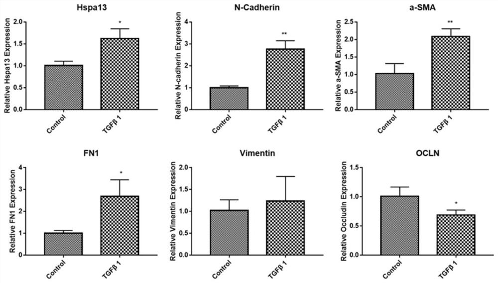 siRNA interfering with hspa13 expression and its application