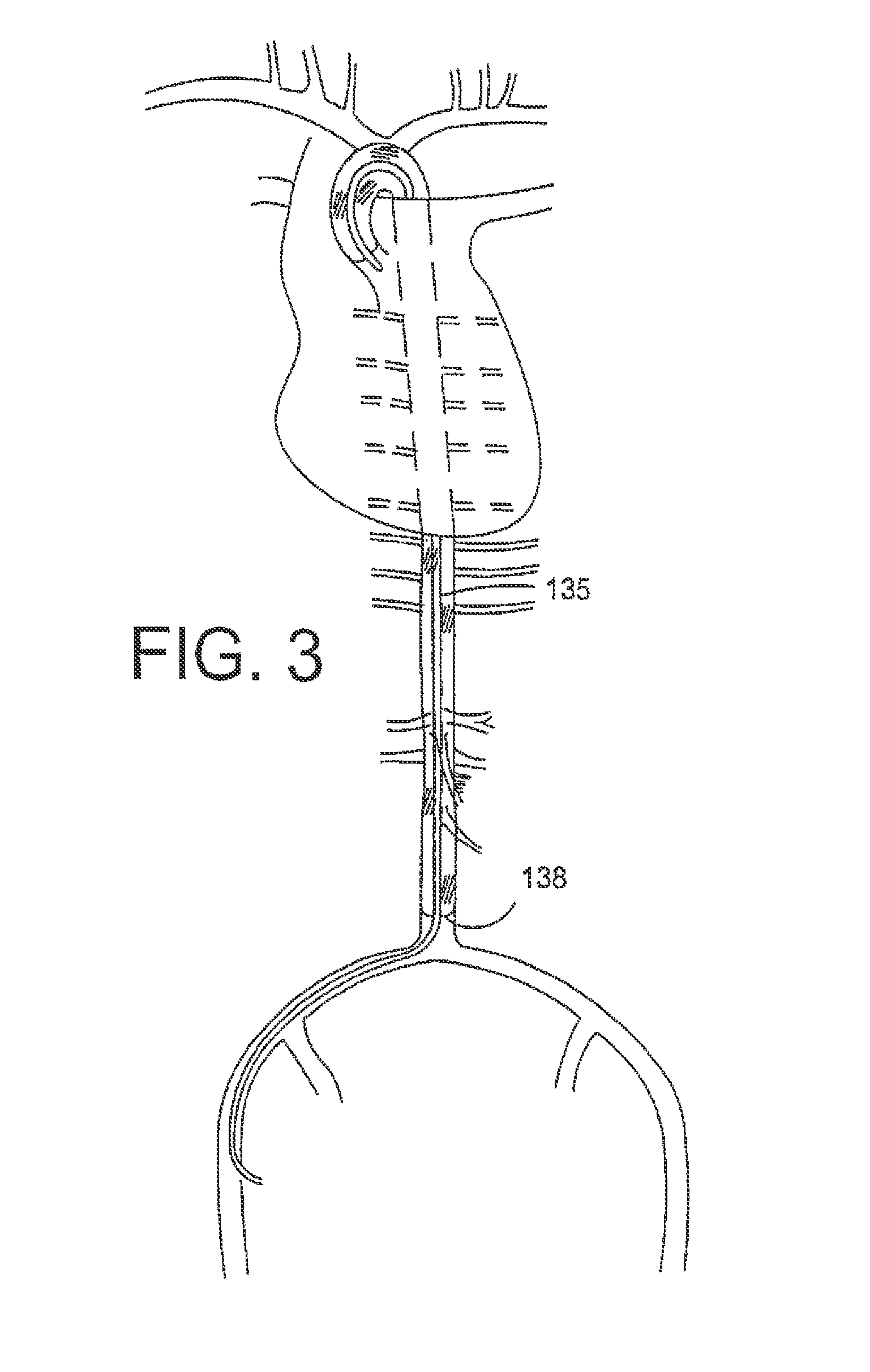 Method for delivering a macromolecular complex to muscle cells