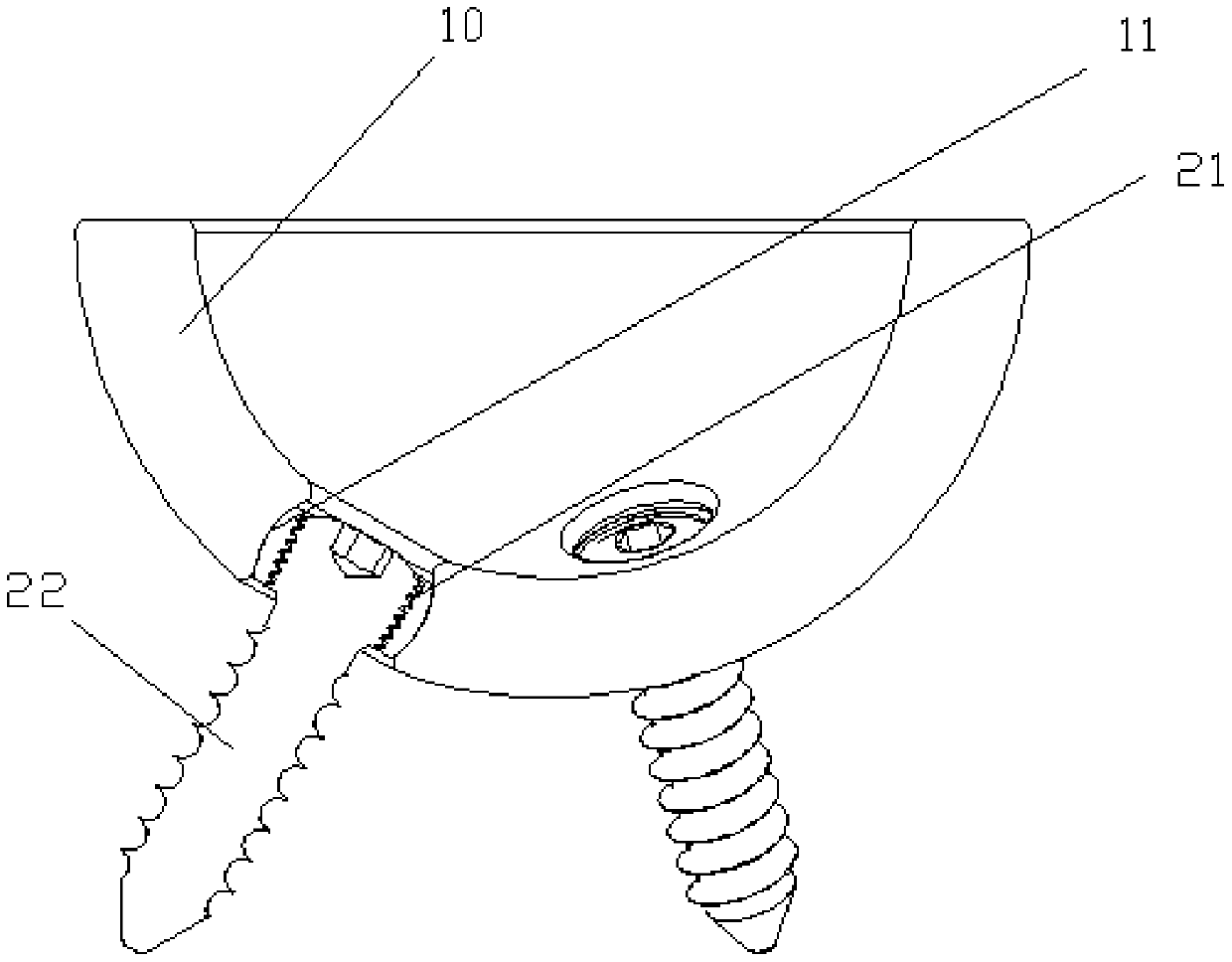 Acetabular prosthesis