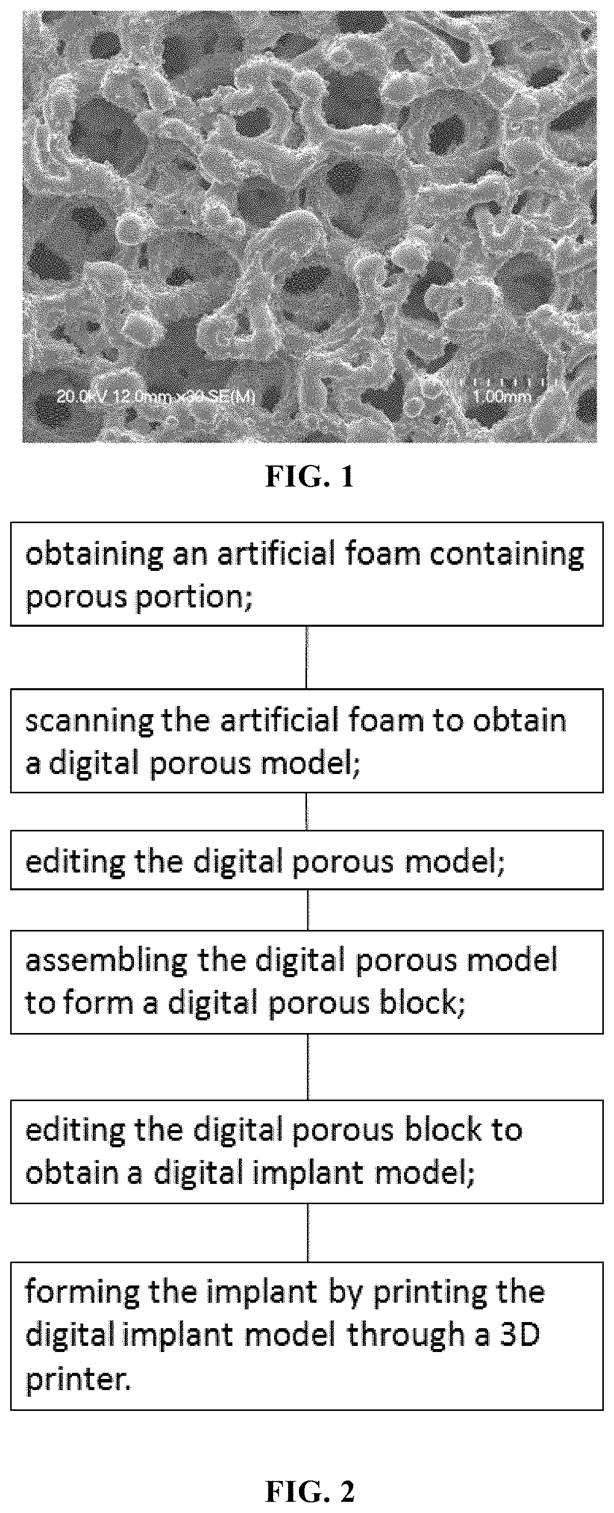 Implant and a method of making the implant and a method of calculating porosity of a porous material