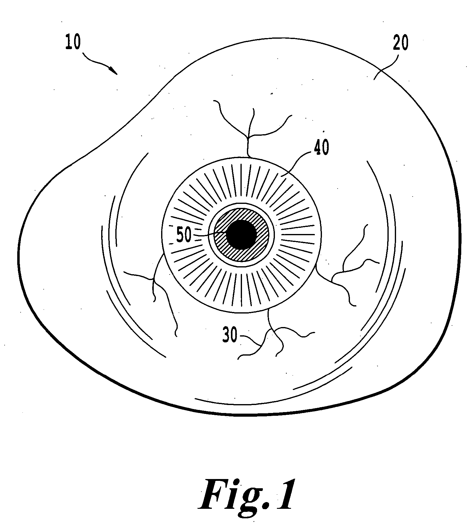 Ocular prosthesis and fabrication method of same