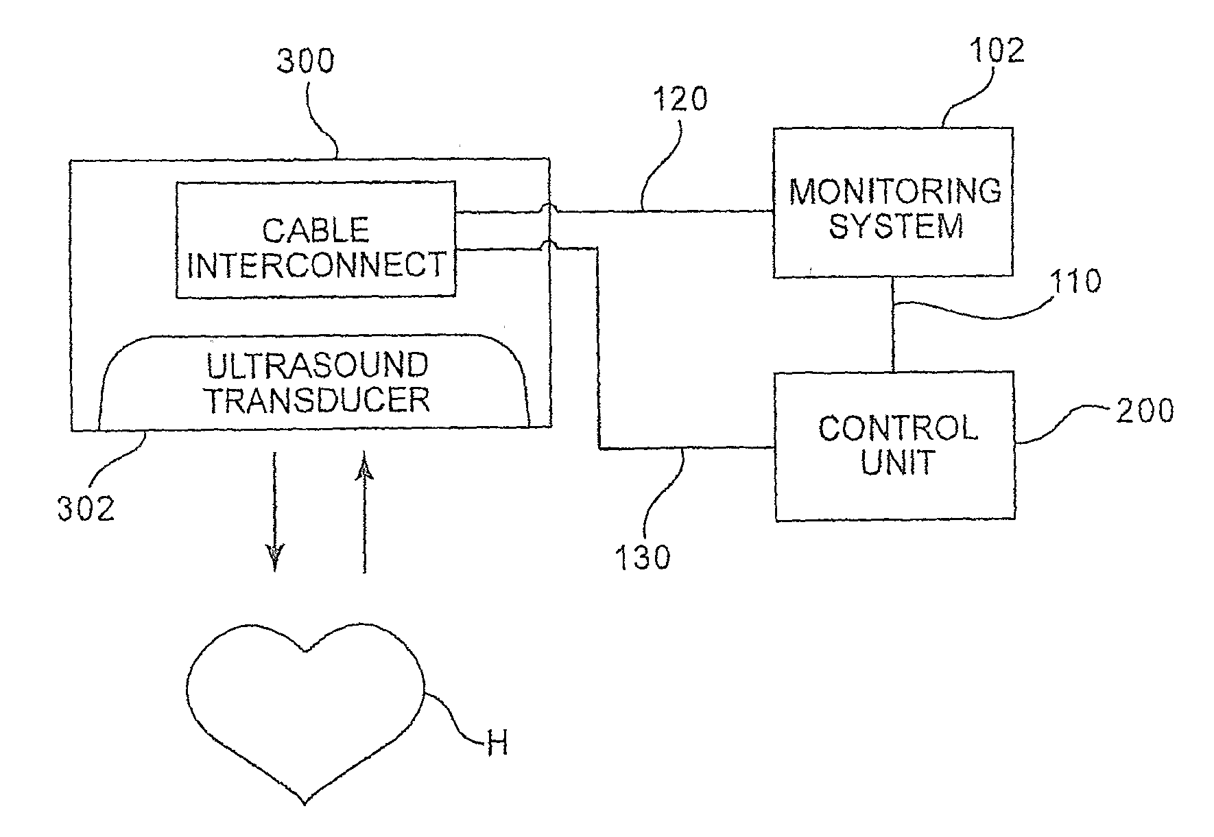 Fetal heart rate monitoring system