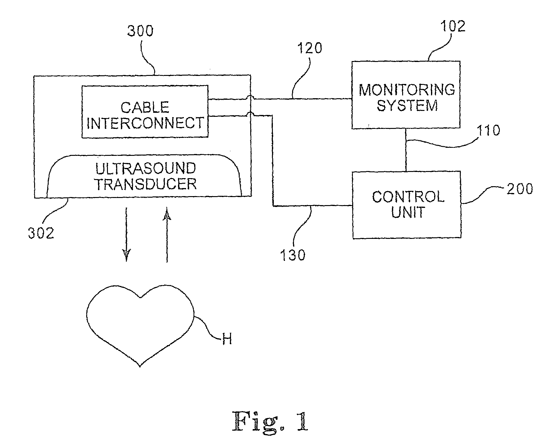 Fetal heart rate monitoring system