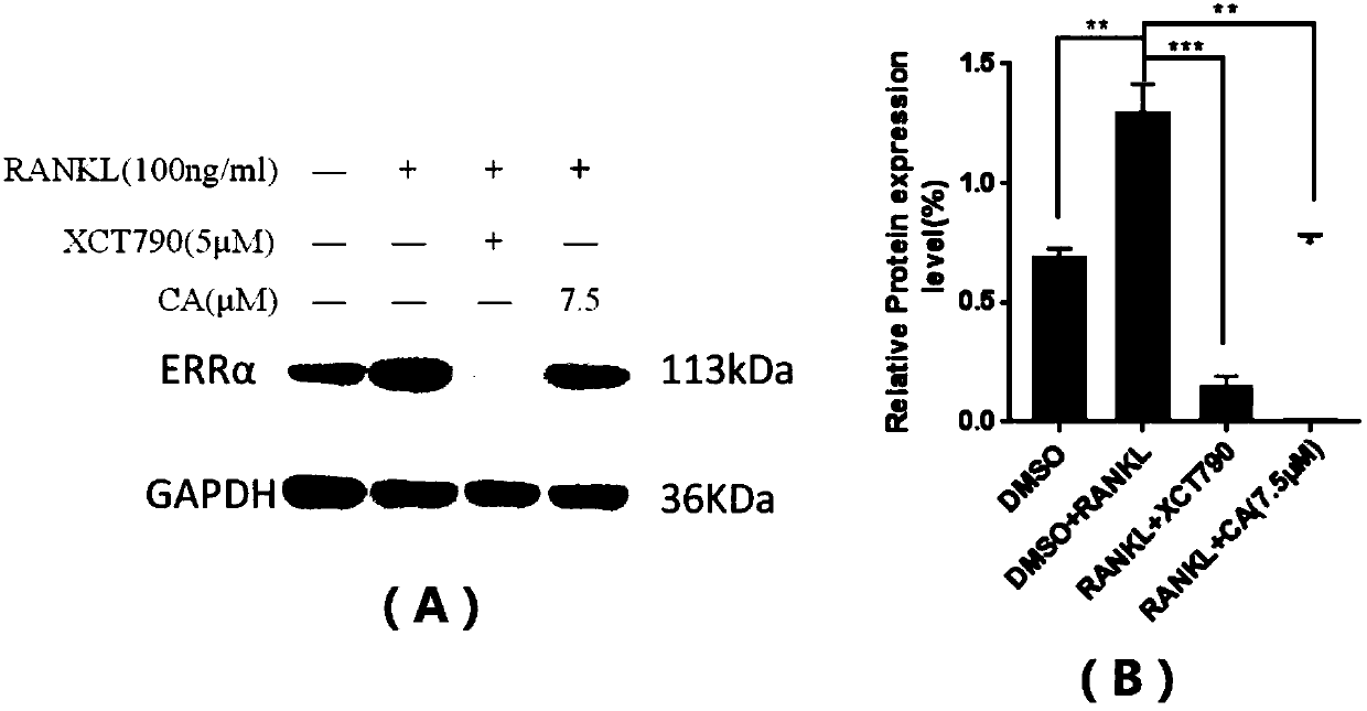 Application of carnosic acid in preparing ERRalpha (Estrogen-Related Receptor alpha) expression inhibitor and medicine for treating osteoporosis