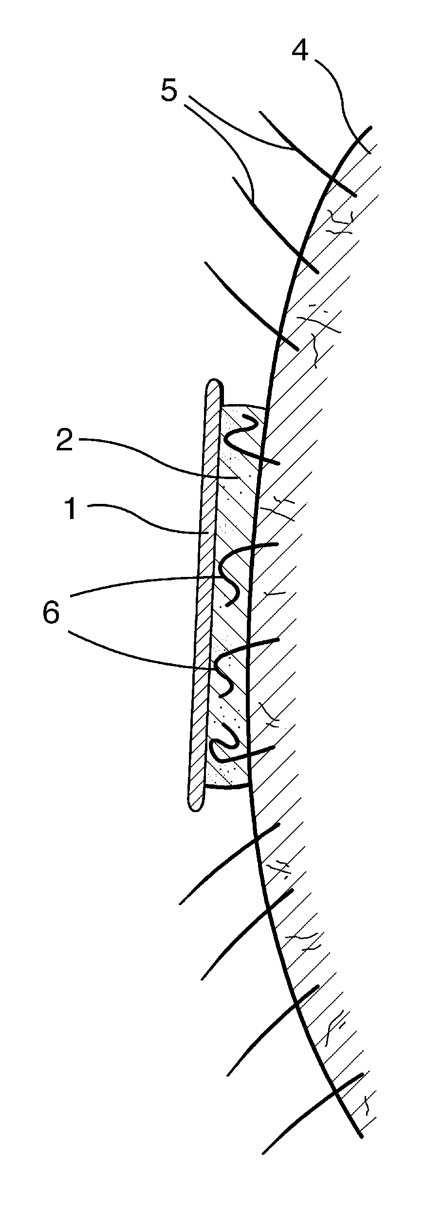 Flexible Aqueous Depilatory Article