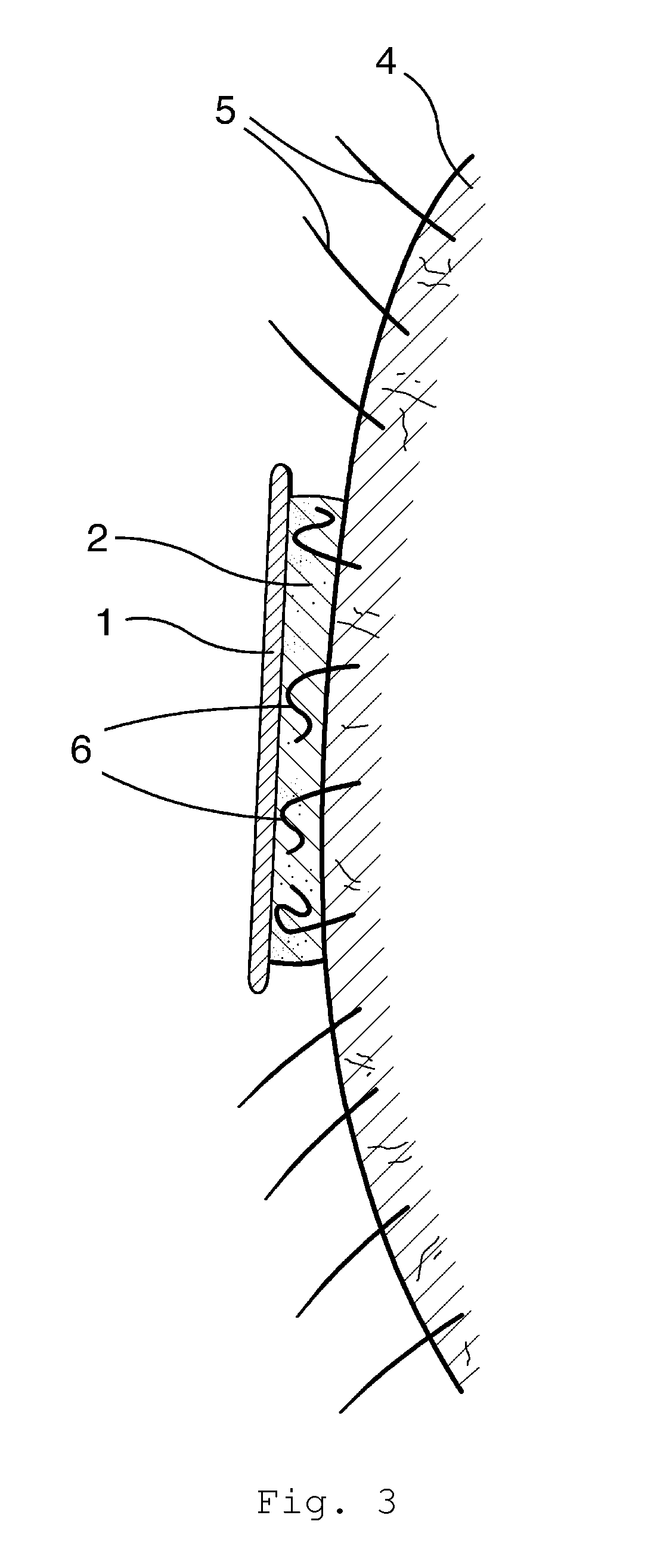 Flexible Aqueous Depilatory Article