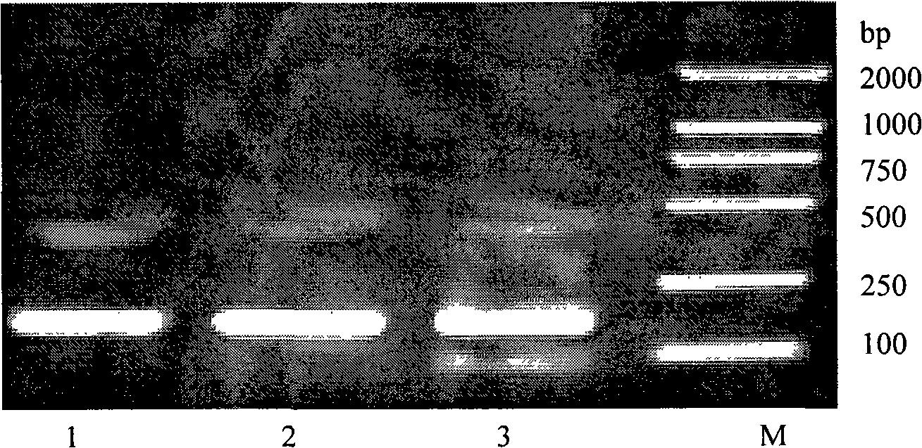 Multi-type HCV-E1 epitope complex immunogen, encoding gene and application thereof