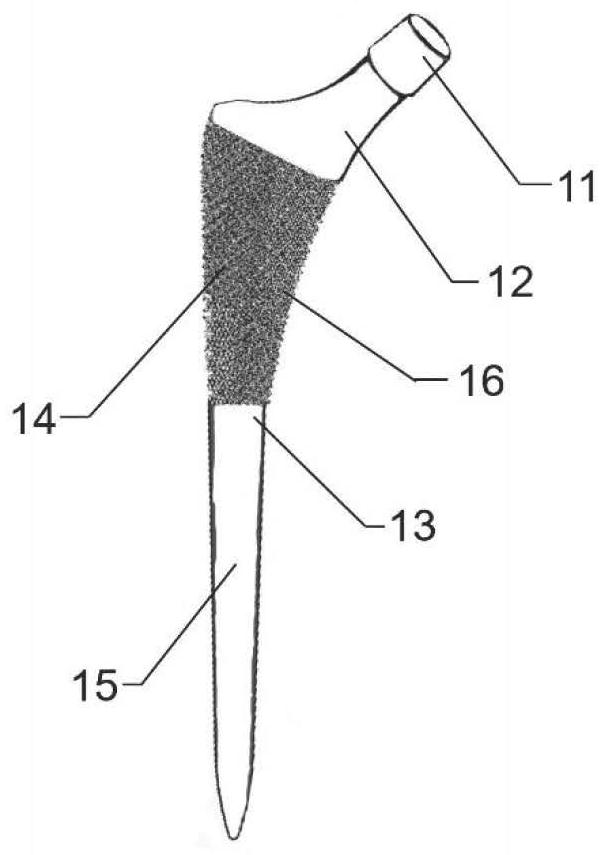 Zirconium-niobium alloy hip joint prosthesis system containing oxide layer and preparation method