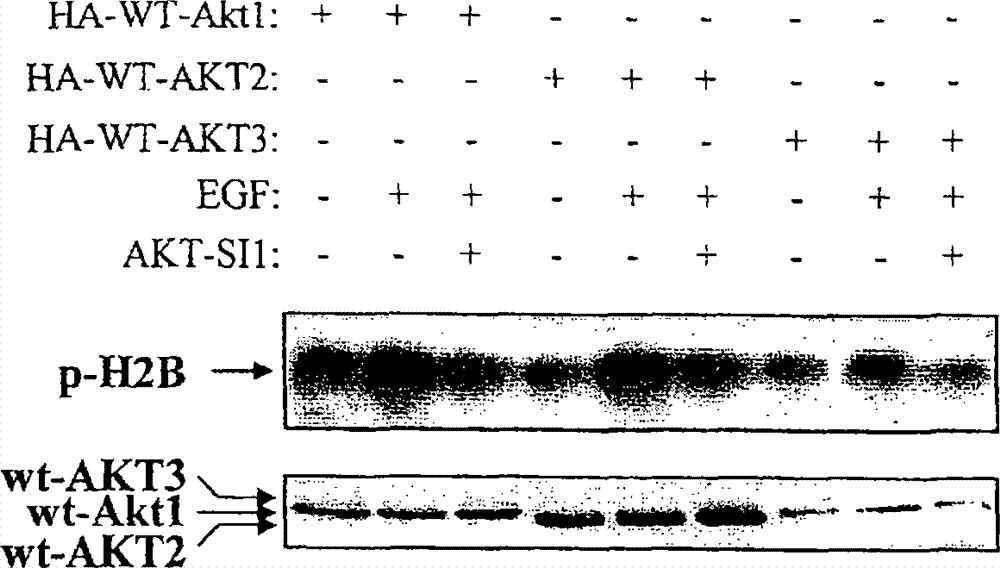 Inhibitors of AKT/PKB with anti-tumor activity