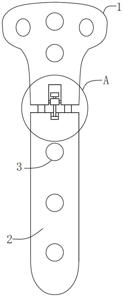 Separated bone plates for high tibial osteotomy