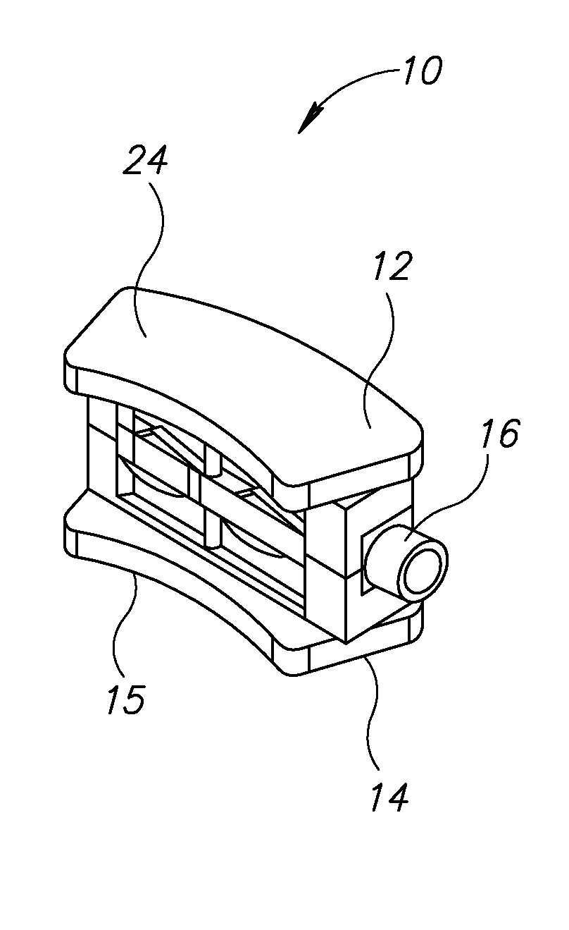 Expandable bone device