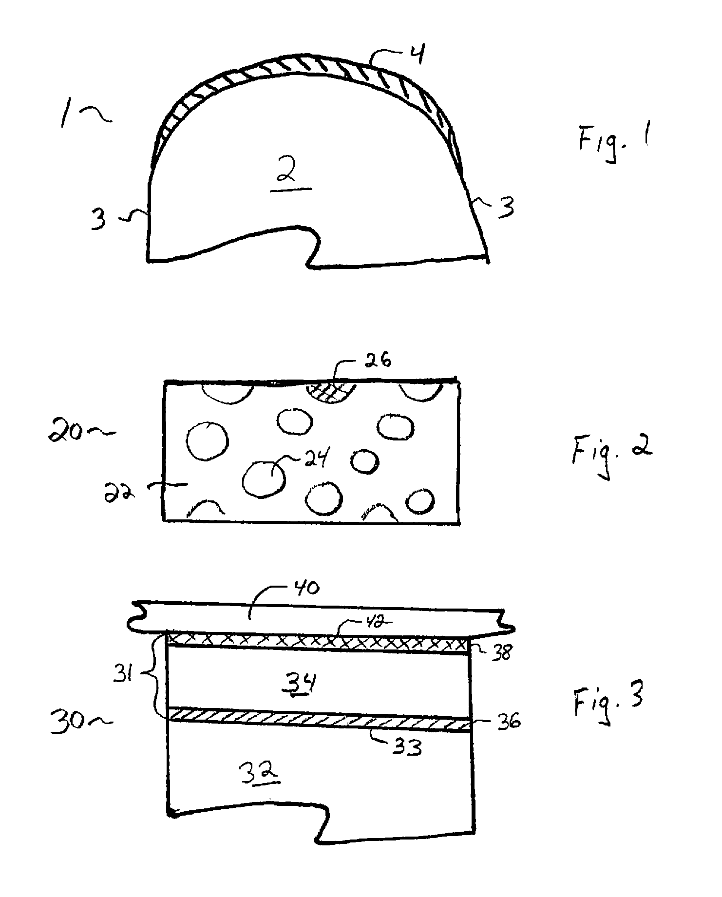 Protective Dental Balm and Method