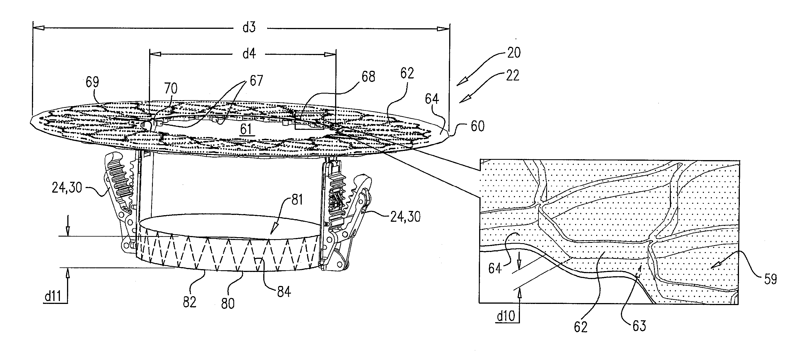 Percutaneous mitral valve replacement and sealing