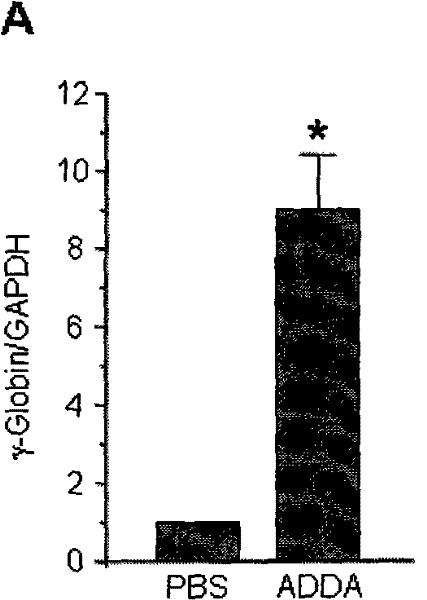 Application of ADDA and/or DMTA in preparing medicine for improving expression level of gamma-globin