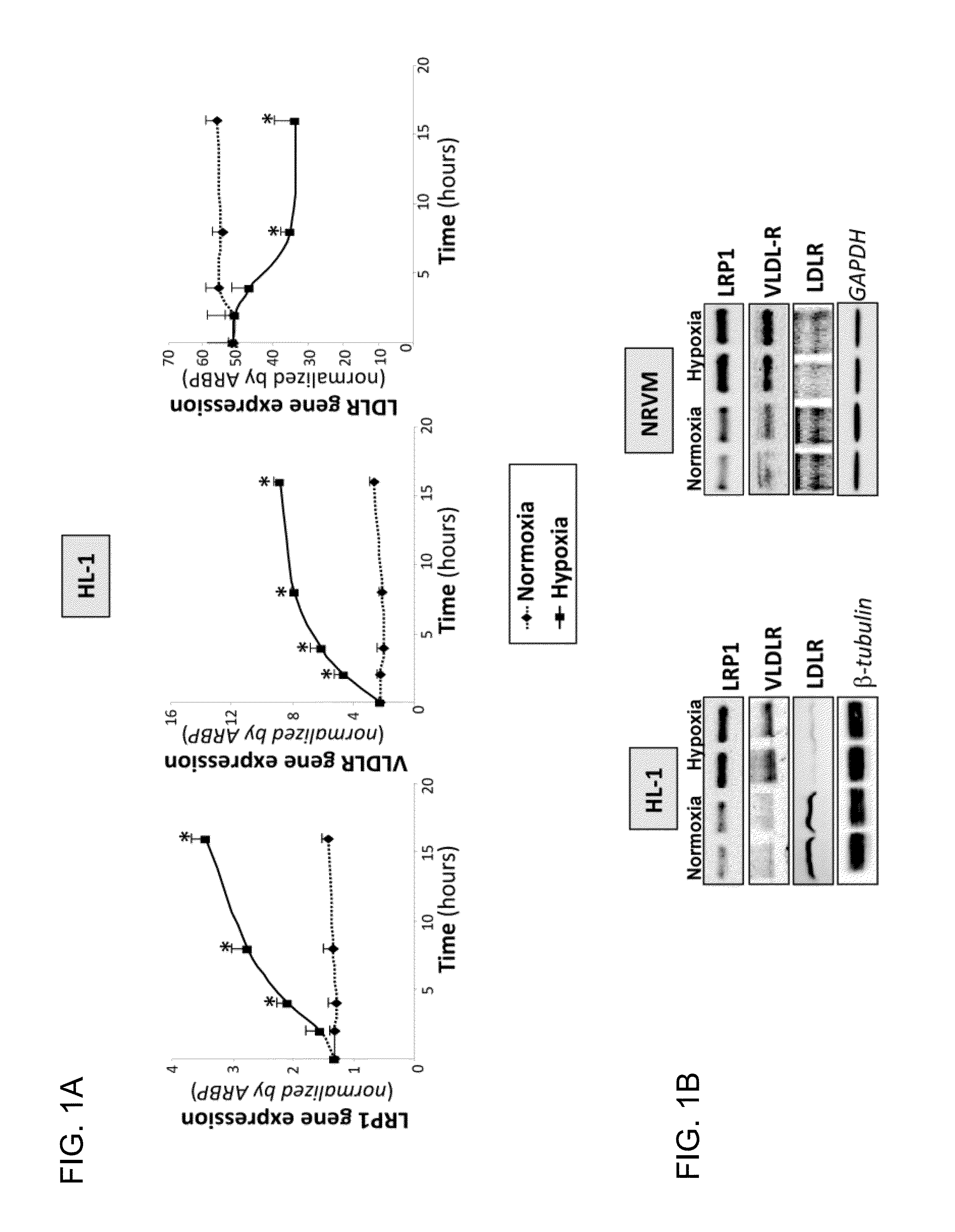 LRP1 as key receptor for the transfer of sterified cholesterol from very-low-density lipoproteins (VLDL) to ischaemic cardiac muscle