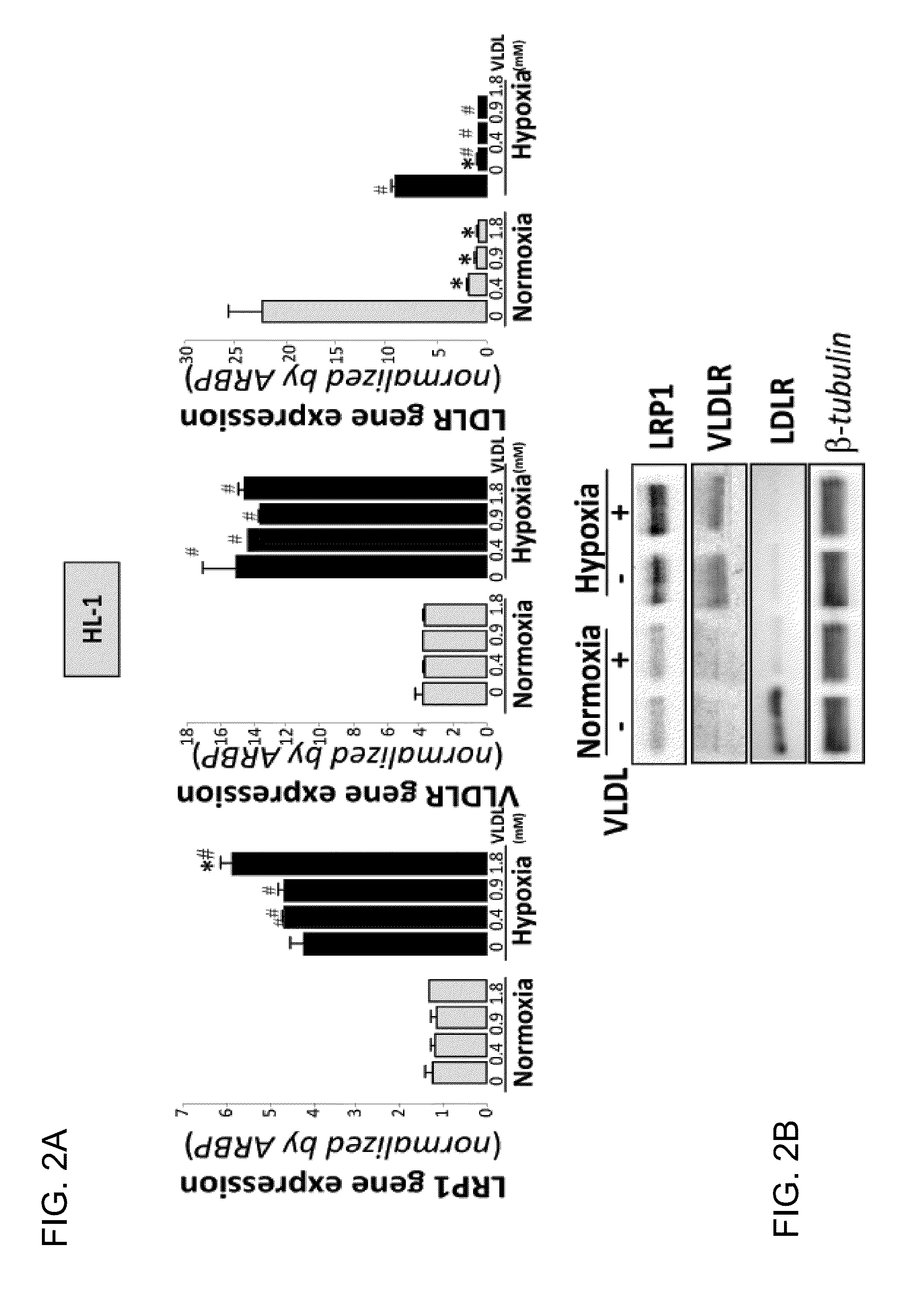 LRP1 as key receptor for the transfer of sterified cholesterol from very-low-density lipoproteins (VLDL) to ischaemic cardiac muscle