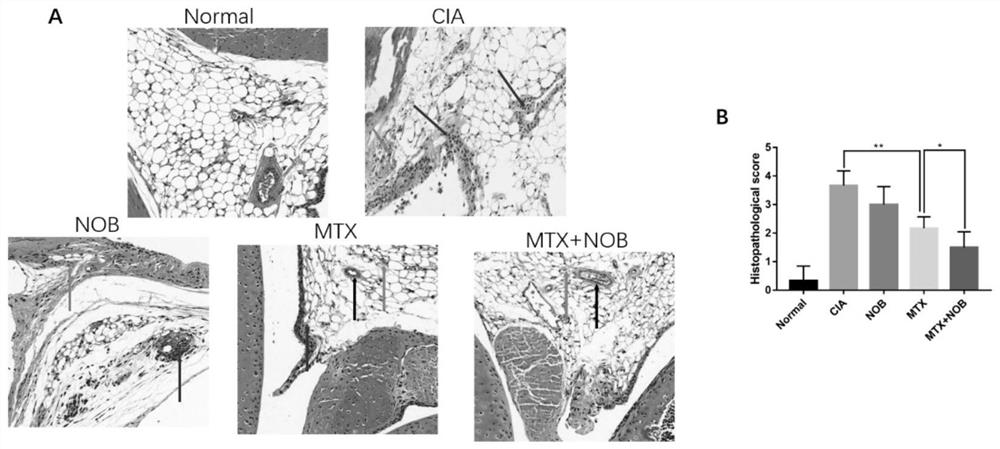 New application of nobiletin and nobiletin composition