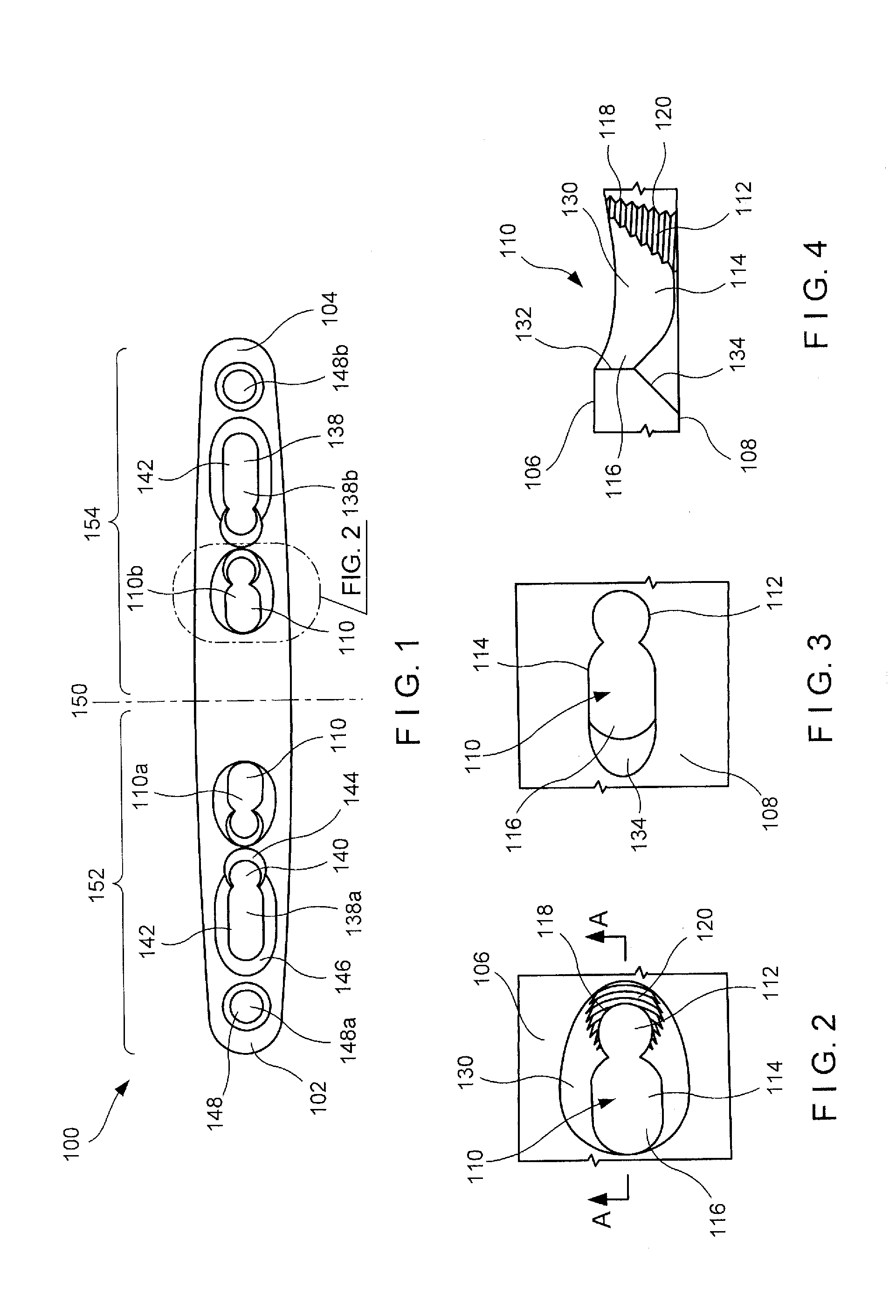 Ulna Osteotomy System