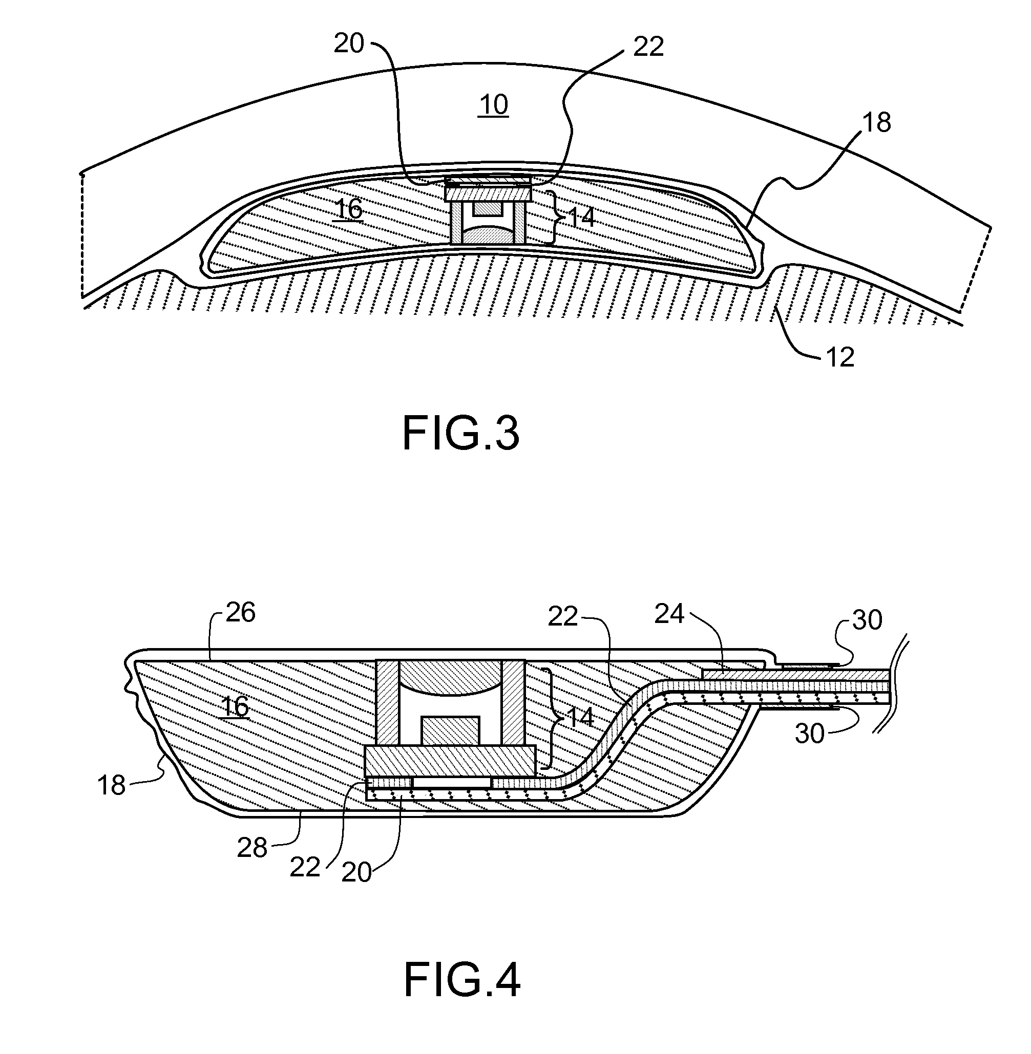 Biomedical interface pressure transducer for medical tourniquets