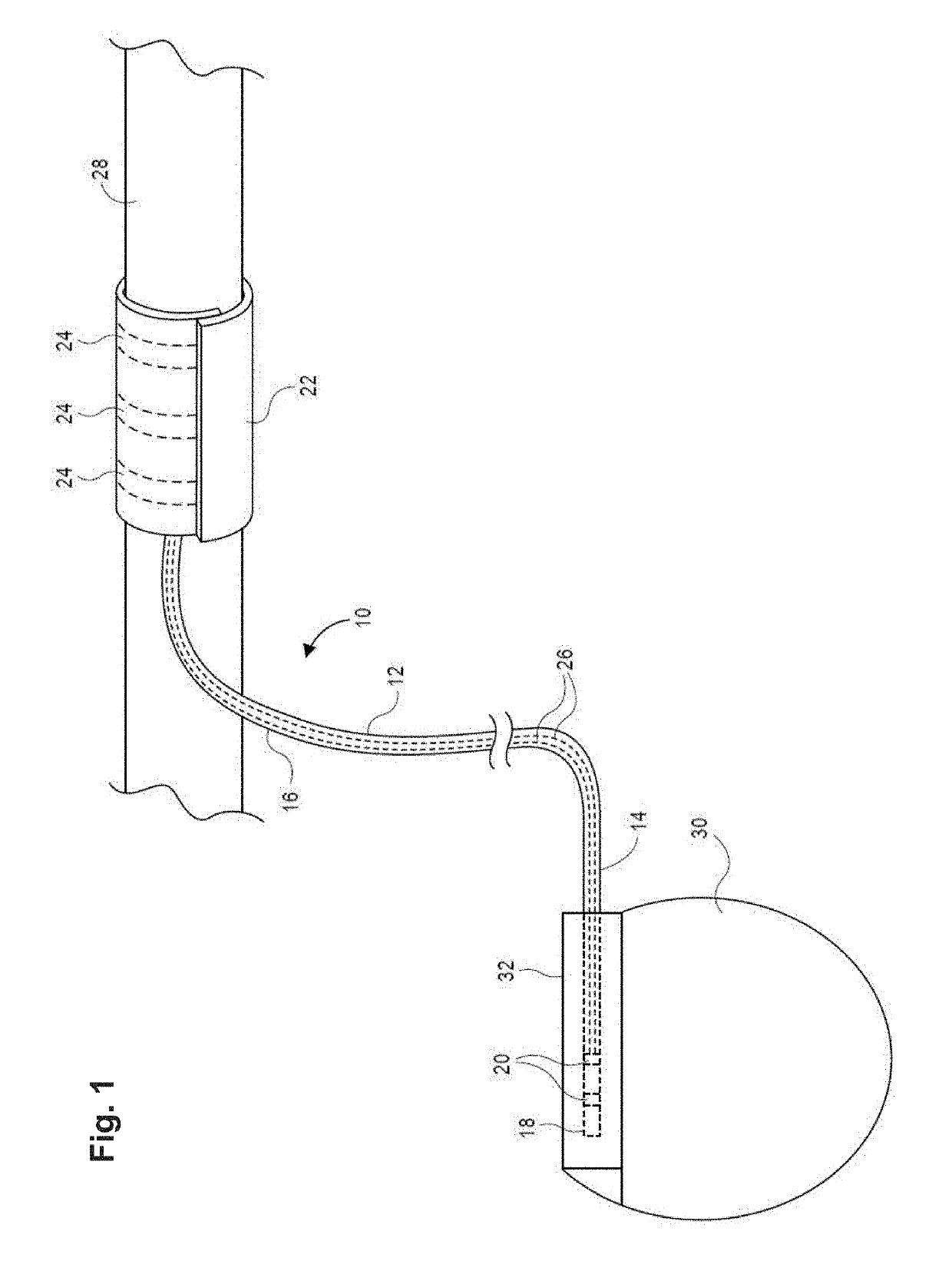 Nerve cuff electrodes fabricated using over-molded lcp substrates