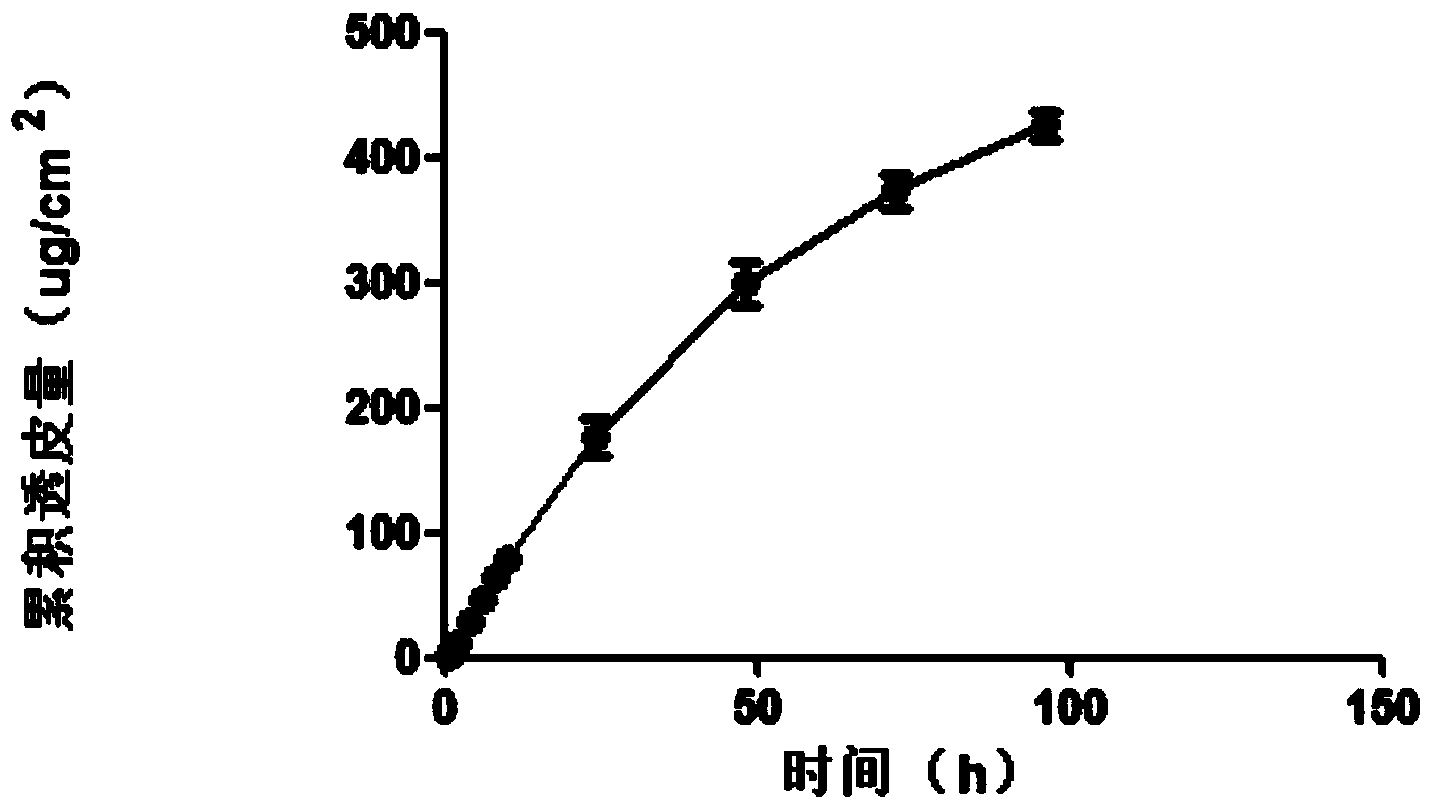 Transdermal delivery preparation in three-dimensional netty spatial configuration of agomelatine and preparation method thereof