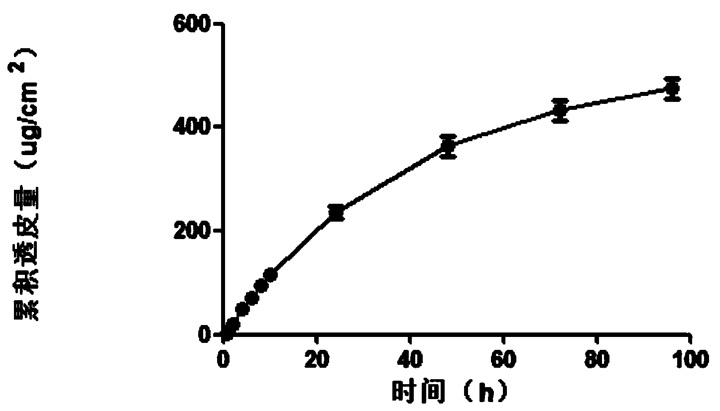 Transdermal delivery preparation in three-dimensional netty spatial configuration of agomelatine and preparation method thereof