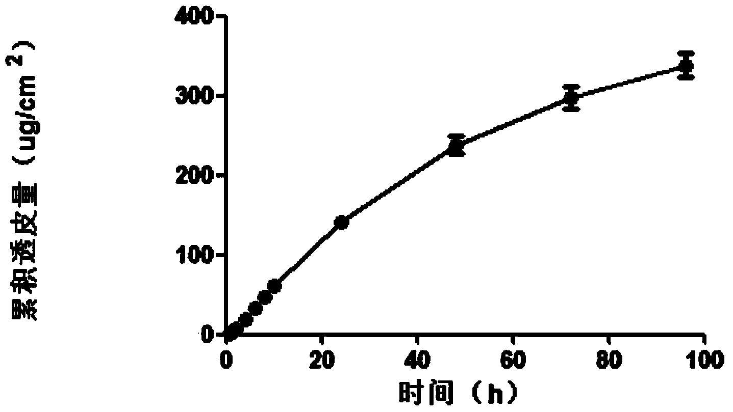 Transdermal delivery preparation in three-dimensional netty spatial configuration of agomelatine and preparation method thereof