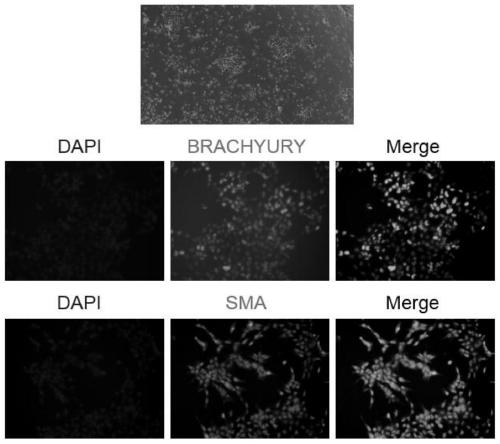 Method for differentiating human pluripotent stem cells into mesoderm