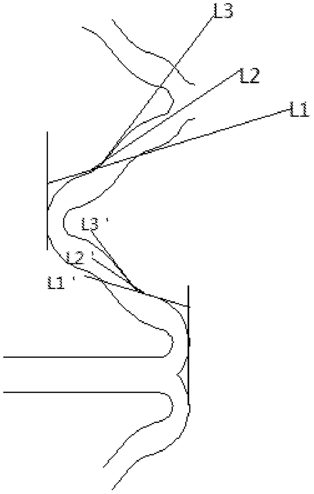 An implantable fully bioabsorbable vascular polymer scaffold